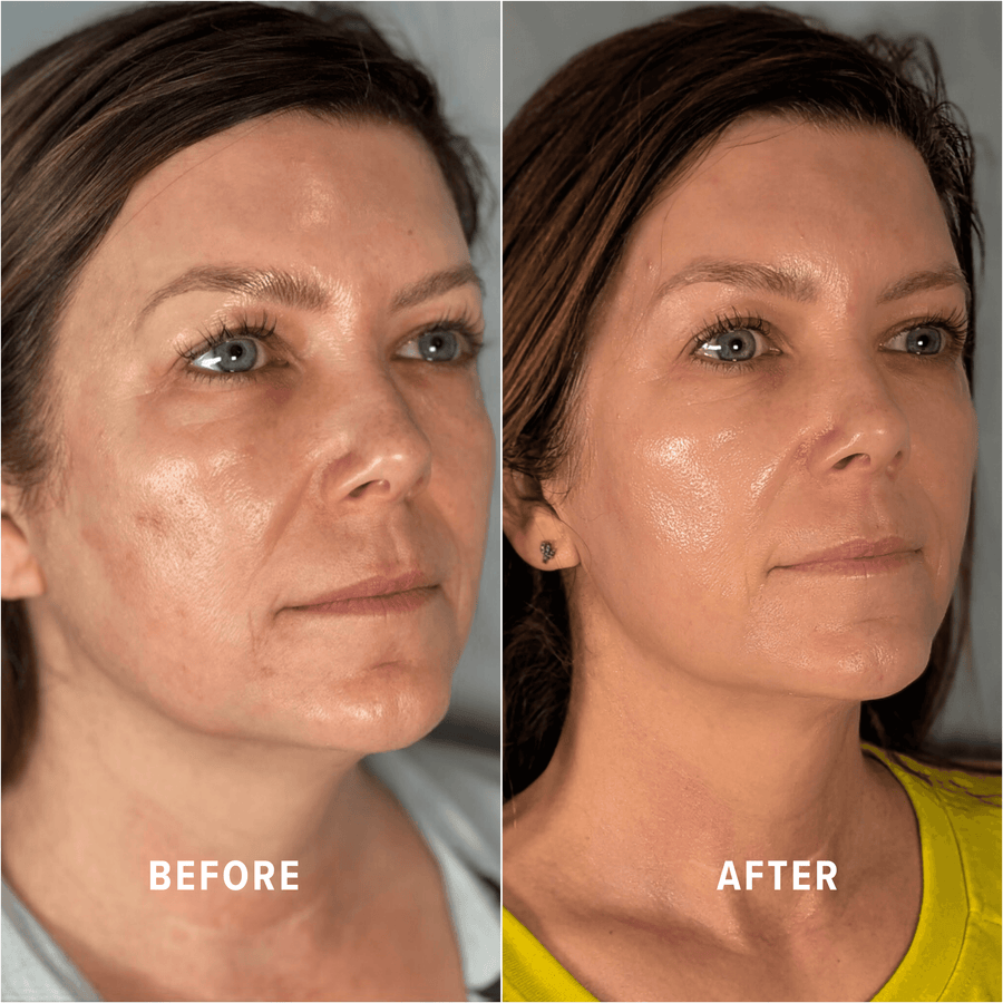 A Boho client's skin before and after treatment