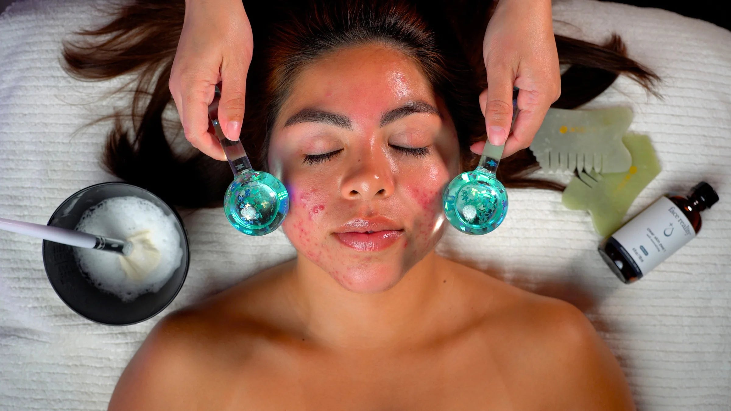 A guest with active breakouts resting with her eyes closed while two ice globes glide over her cheeks