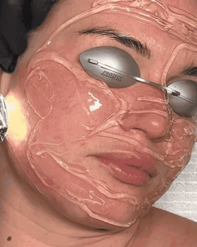 An IPL handpiece glowing at the edge of a guest's gel-covered face, her eyes shielded