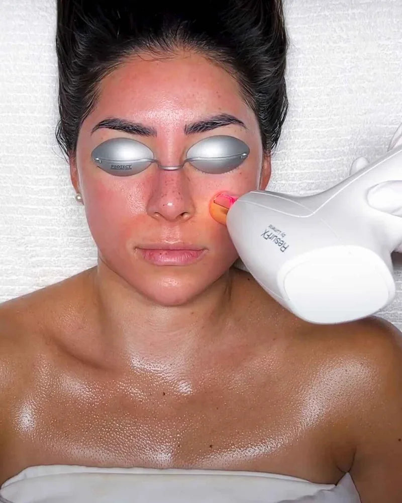 A ResurFX handpiece at a guest's cheek, her eyes covered with protective eyewear